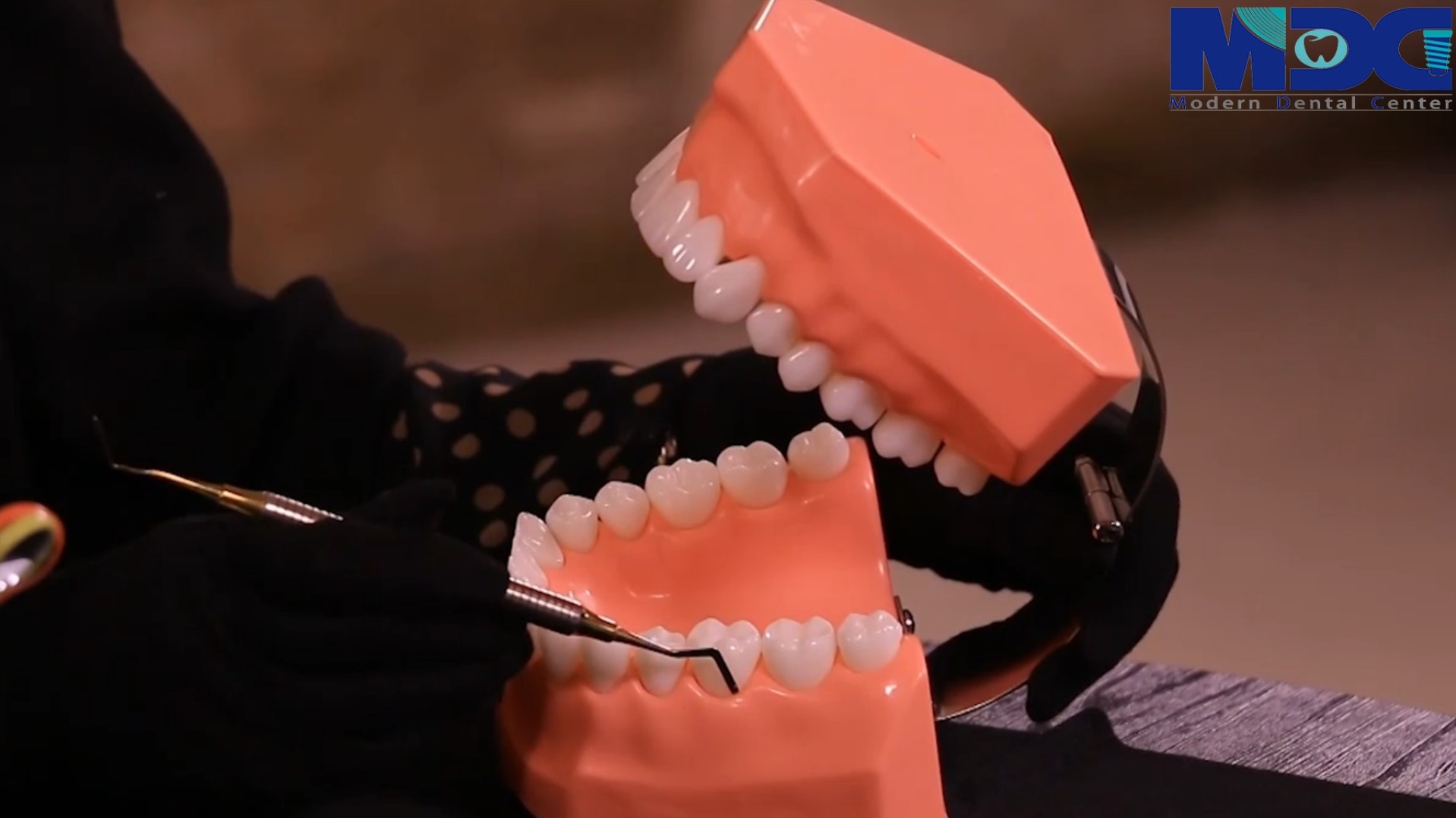 آموزش پیشگیری از پوسیدگی دندان
