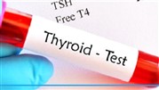 آزمایش تیروئید چیست + نحوه انجام