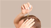 موهای کاشته شده خود را با ماینوکسیدیل تقویت کنید!
