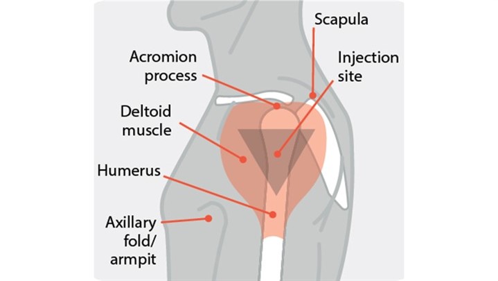 کرونا: روش غلط تزریق واکسن، عامل اصلی لخته خون و حمله قلبی!