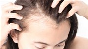 کاشت موی خانم ها: راهی برای بازگرداندن اعتماد به نفس
