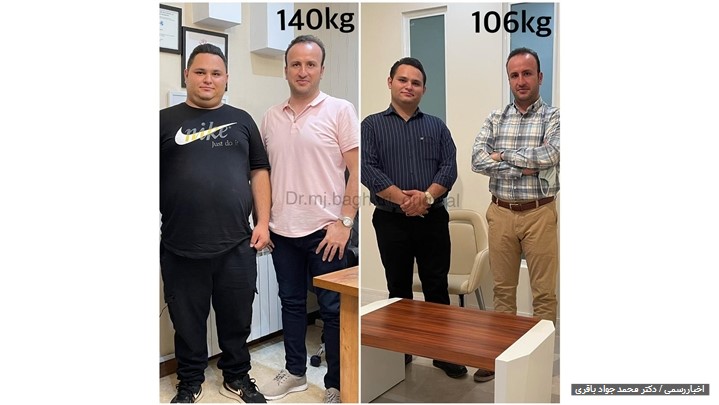 اهمیت جراحی لاغری توسط بهترین متخصص لاغری