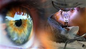 کشور ایران؛ مقصد محبوب جراحی چشم برای بیماران عراقی 