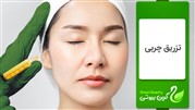 تزریق چربی در تهران