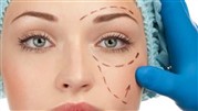 ایا همزمان با جراحی صورت بلفاروپلاستی یا پلک هم انجام میشود؟